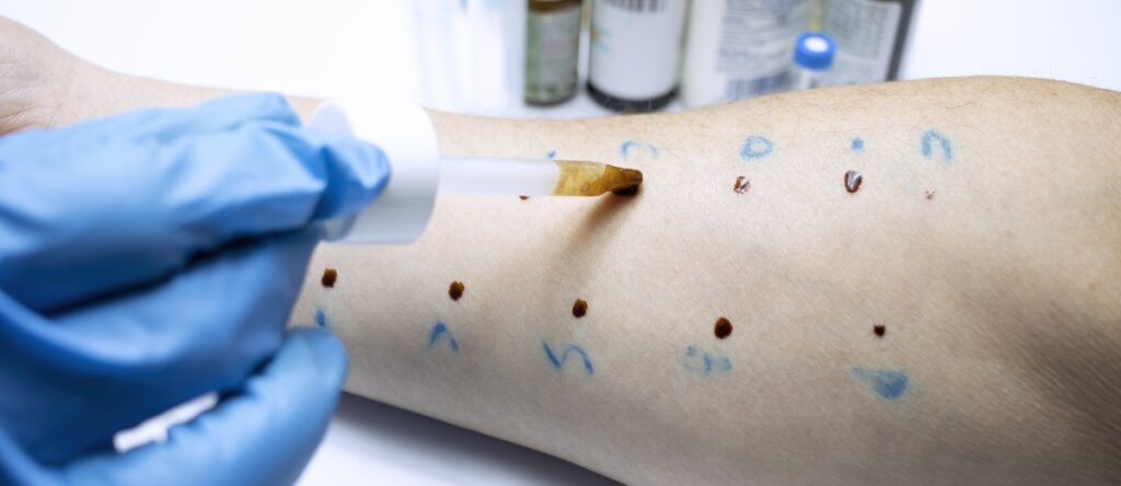 allergologo santagostino roma san lorenzo