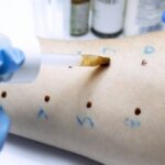 allergologo santagostino roma san lorenzo