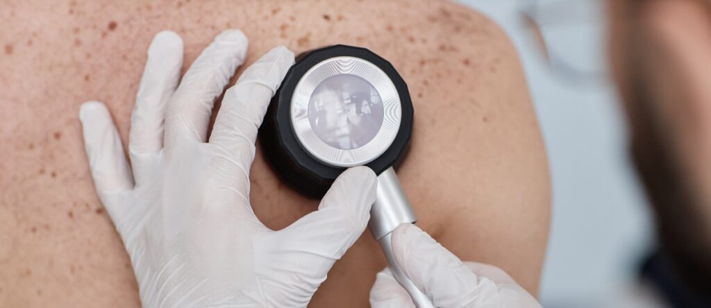 visita dermatologica santagostino san lorenzo