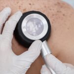 visita dermatologica santagostino san lorenzo