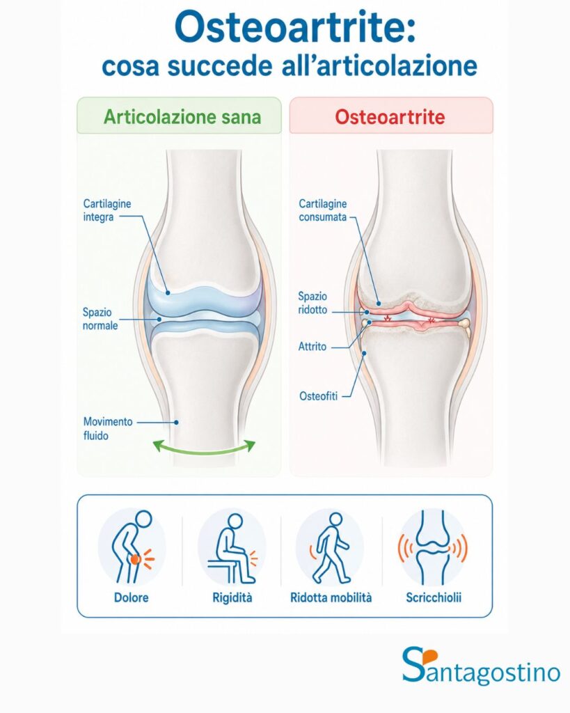 cosa succede all'articolazione con l'osteoartrite
