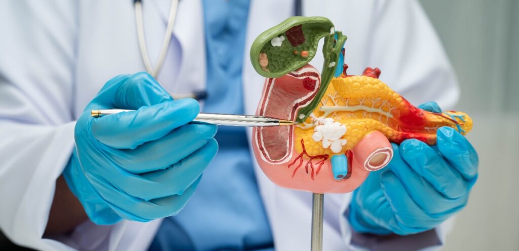 pancreatite cronica
