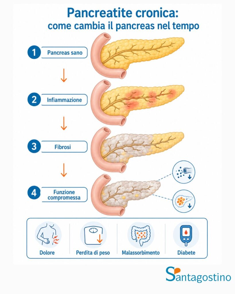 pancreatite cronica come cambia il pancreas