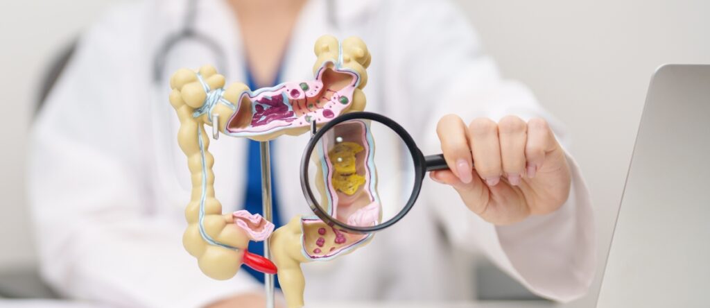 colon irritabile santagostino rho
