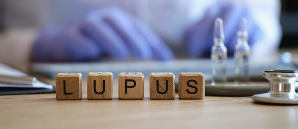 lupus san lorenzo